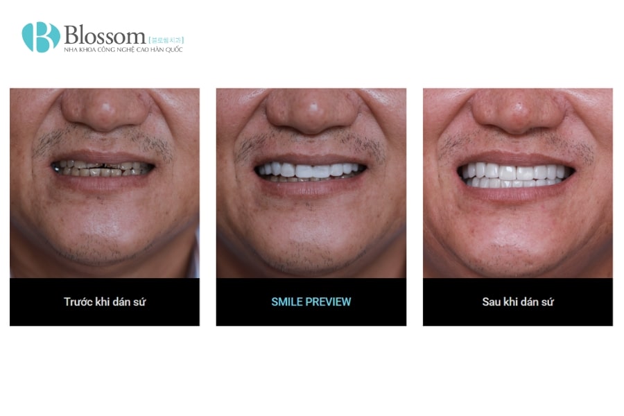 dan su khong mai co dau khong 8 min