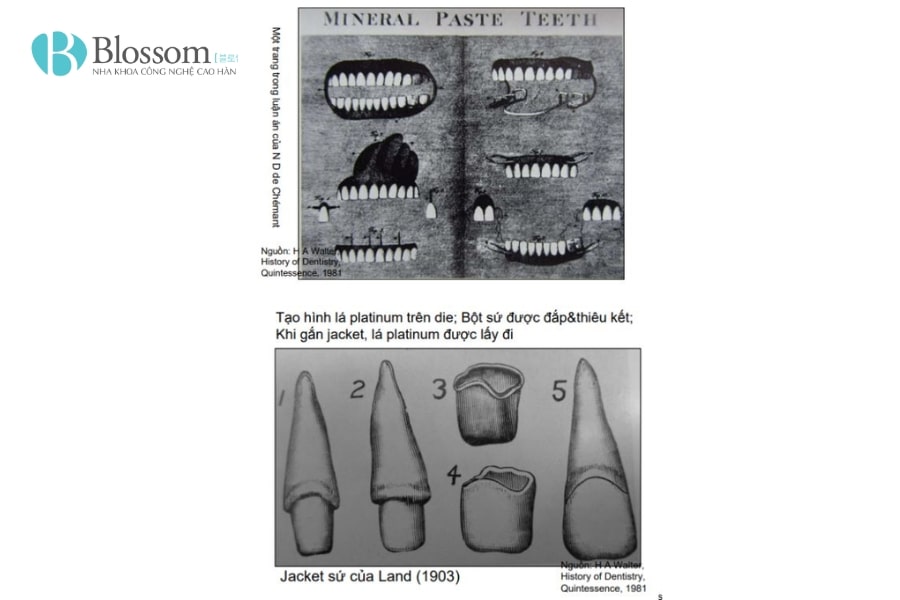 Lịch sử thẩm mỹ răng sứ: Hành trình phát triển từ cổ đại đến hiện đại 4 lich su tham my rang su 4 min