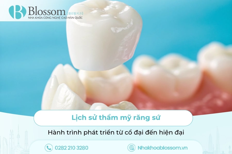 Lịch sử thẩm mỹ răng sứ: Hành trình phát triển từ cổ đại đến hiện đại