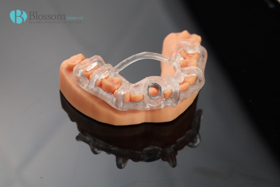 mang huong dan phau thuat 3d 1 min