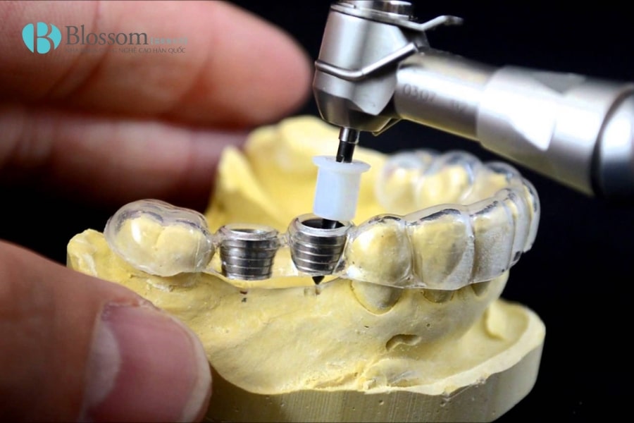 mang huong dan phau thuat 3d 4 min