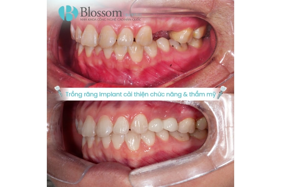 mang huong dan phau thuat 3d 6 min