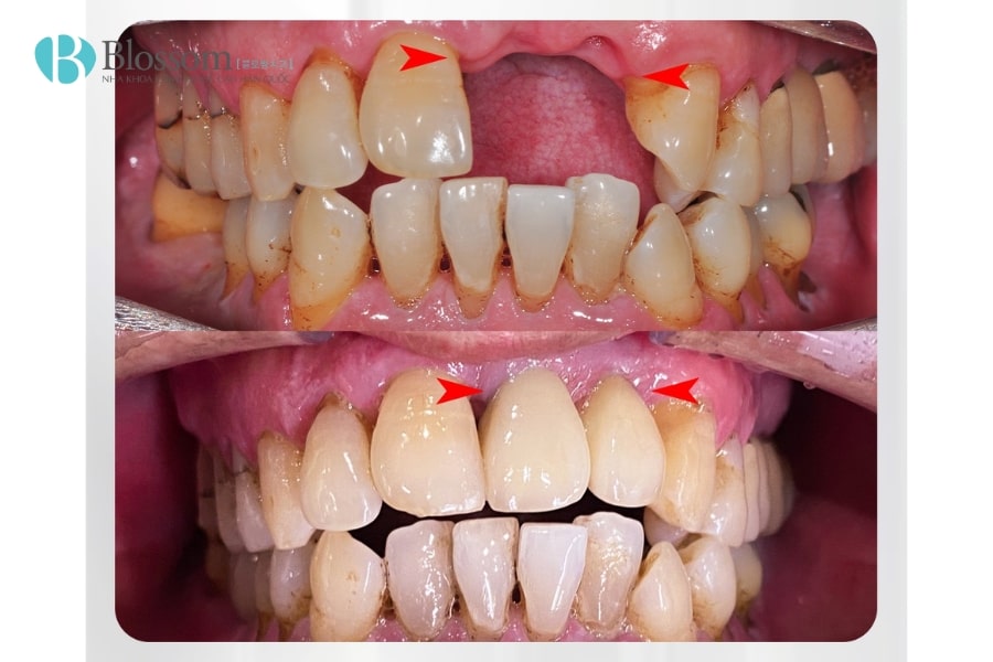 mang huong dan phau thuat 3d 7 min