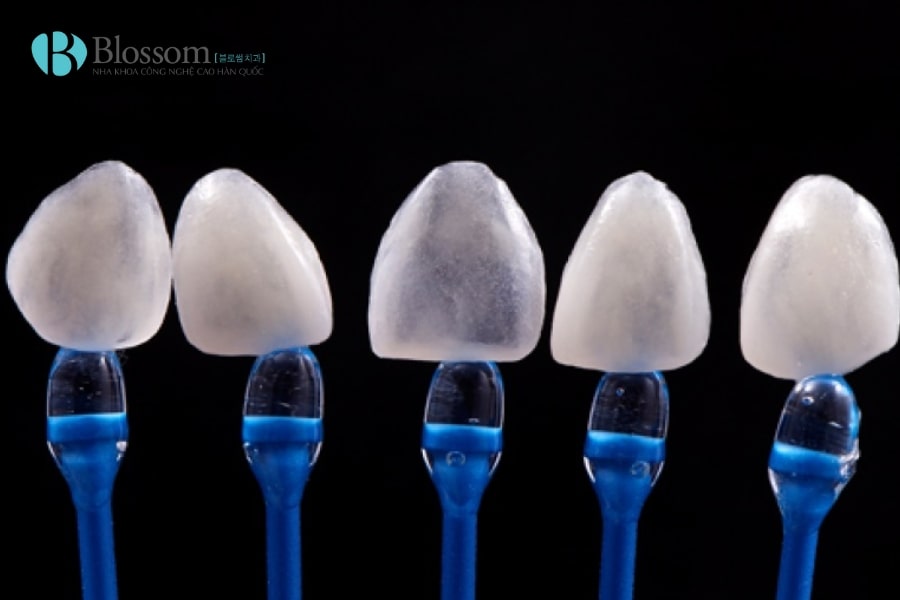 Quy trình dán sứ không mài Lamifilm: Công nghệ phục hình thẩm mỹ 0.1mm độc quyền tại Nha khoa Blossom 1 quy trinh dan su khong mai lamifilm 1 min