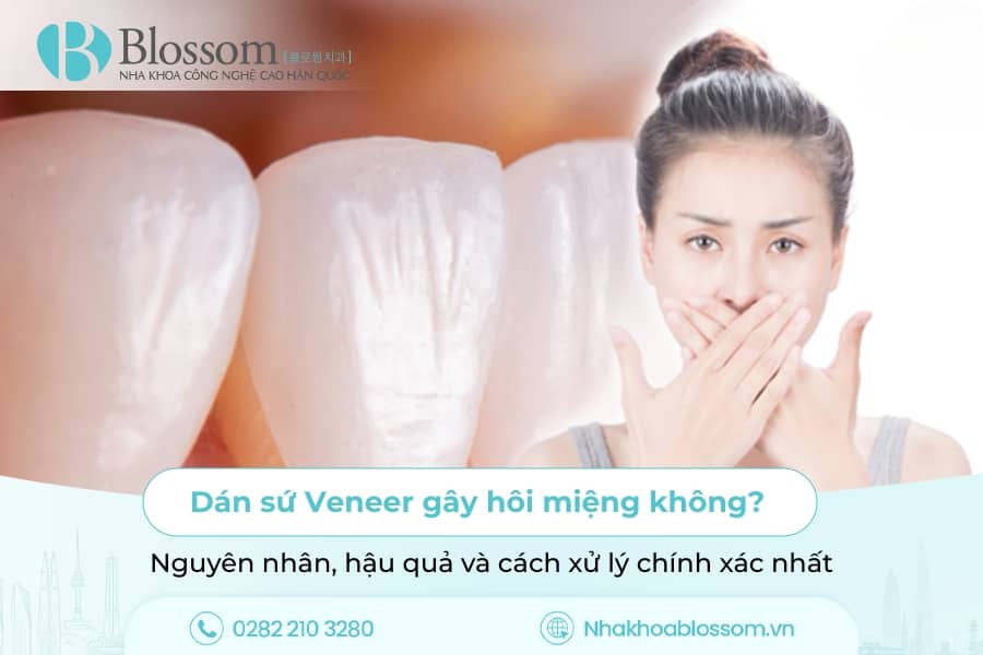 Dán sứ Veneer gây hôi miệng không? Nguyên nhân, hậu quả và cách xử lý chính xác nhất