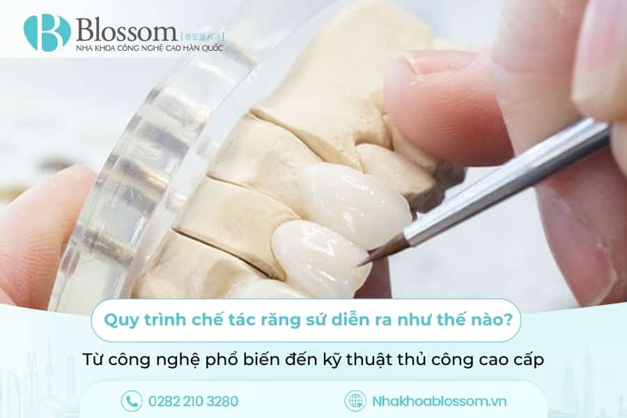 Quy trình chế tác răng sứ diễn ra như thế nào? Từ công nghệ phổ biến đến kỹ thuật chế tác thủ công cao cấp