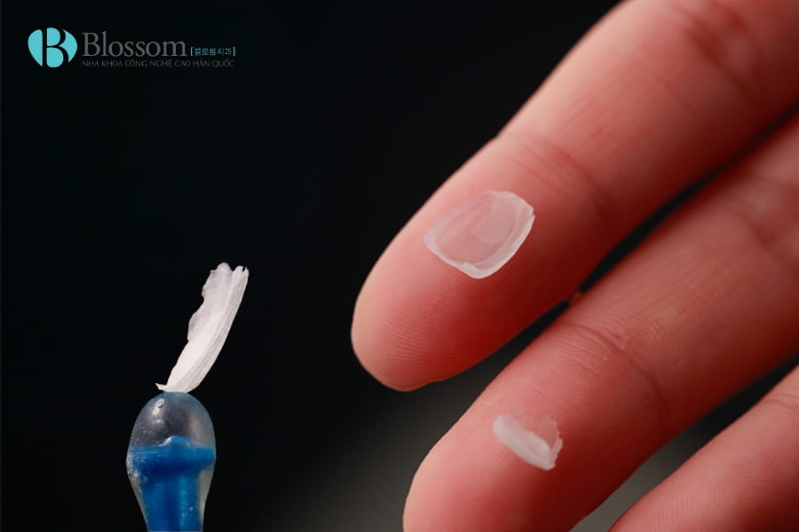 Bọc răng sứ không mài có được không? Hiểu đúng về mài răng và giải pháp thẩm mỹ không xâm lấn 4 boc rang su khong mai co duoc khong 4 min