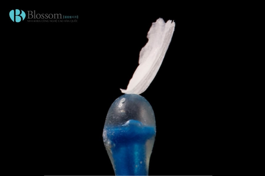 Dán Sứ Không Mài Có Đắt Không? Có Nên Dán Sứ Không Mài Lamifilm? 4 dan su khong mai co dat khong 4 min