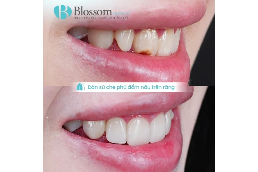 dan su khong mai giu duoc bao lau 2 min 1