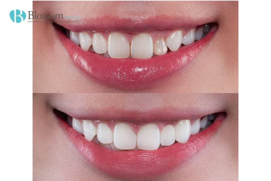 dan su khong mai giu duoc bao lau 3 min 1