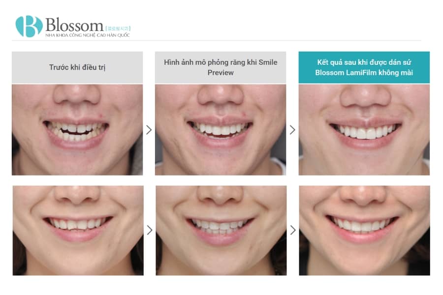 dan su khong mai giu duoc bao lau 6 min 1