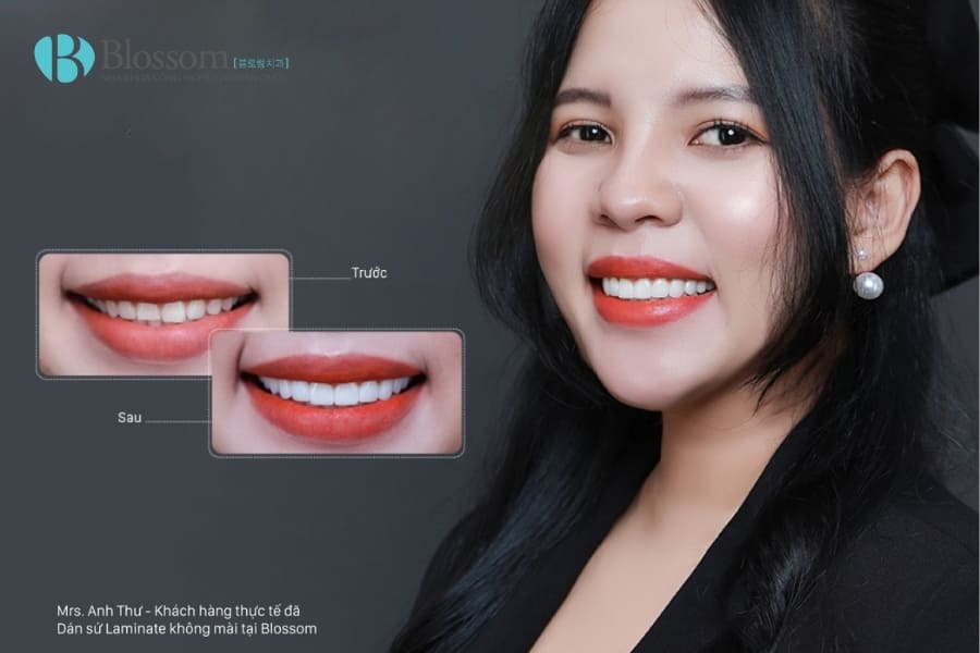 dan su khong mai giu duoc bao lau 7 min 1