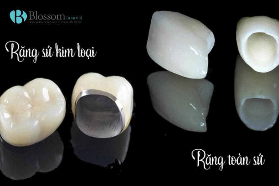 Hậu quả khi làm răng sứ giá rẻ: Những rủi ro bạn cần biết trước khi thực hiện 2 hau qua khi lam rang su gia re 2 min 1