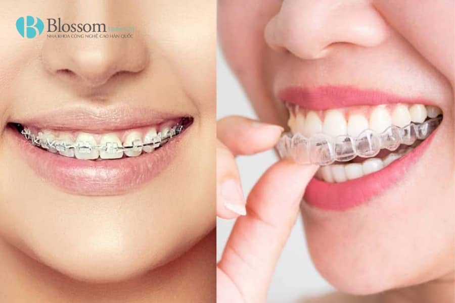 khop thai duong ham co nieng duoc khong 6 min