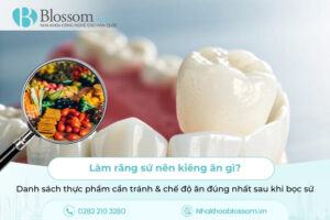 Làm răng sứ nên kiêng ăn gì? Danh sách thực phẩm cần tránh & chế độ ăn đúng nhất sau khi bọc sứ