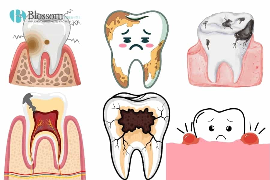 meo chua dau rang 2 min min