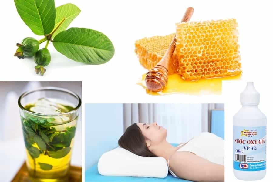 meo chua dau rang 4 min min