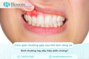 Cảm giác thường gặp sau khi làm răng sứ: Bình thường hay dấu hiệu biến chứng?