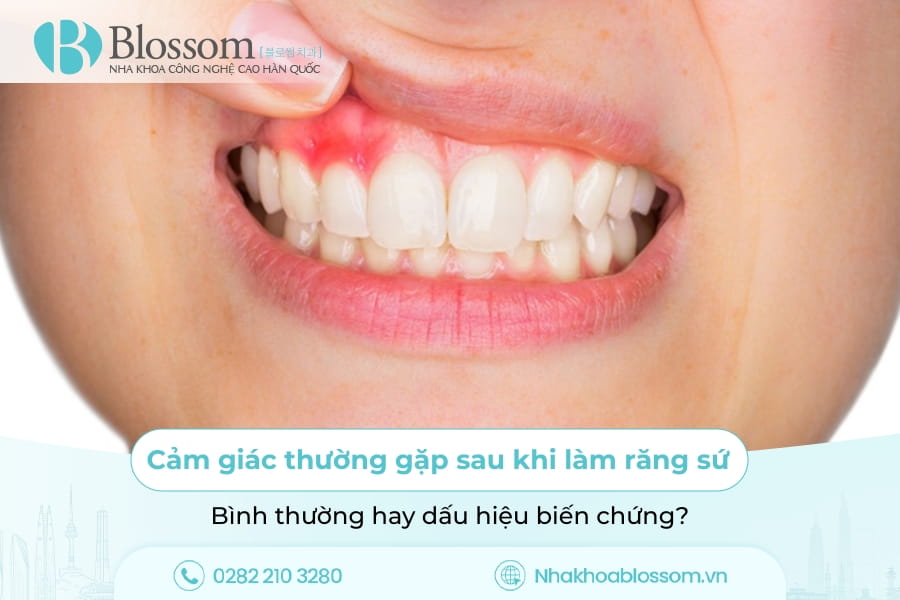 Cảm giác thường gặp sau khi làm răng sứ: Bình thường hay dấu hiệu biến chứng?