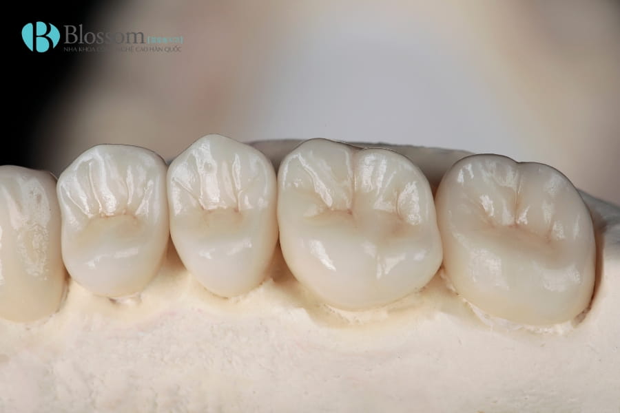 thoi diem lam rang su kip don tet 4 2