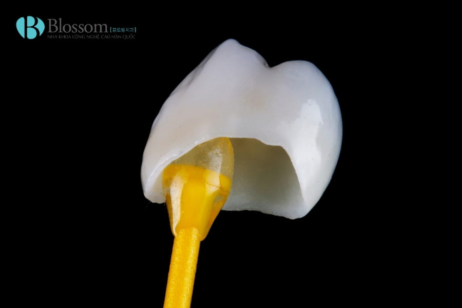 thoi diem lam rang su kip don tet 5 2