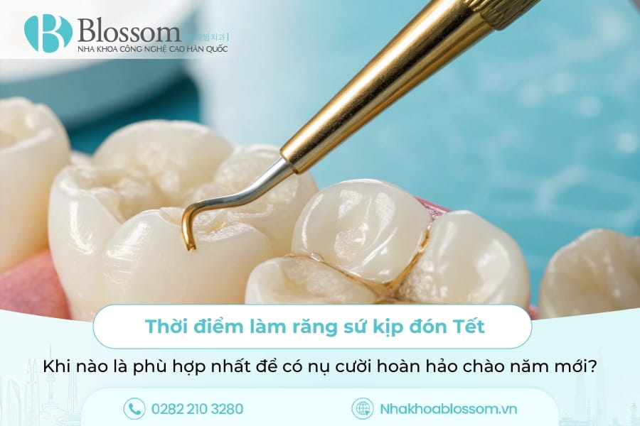 Thời điểm làm răng sứ kịp đón Tết: Khi nào là phù hợp nhất để có nụ cười hoàn hảo chào năm mới?