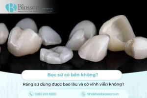 Bọc sứ có bền không? Răng sứ dùng được bao lâu và có vĩnh viễn không?