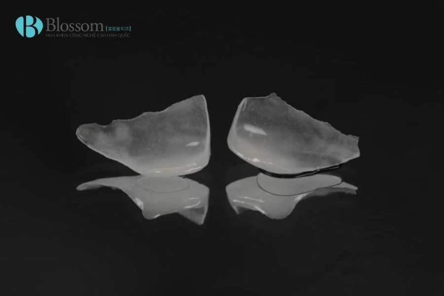 dan su khe thua khong mai rang 1