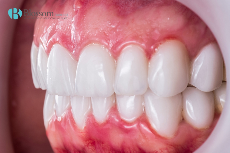 dan su khong mai o dau tot nhat 1