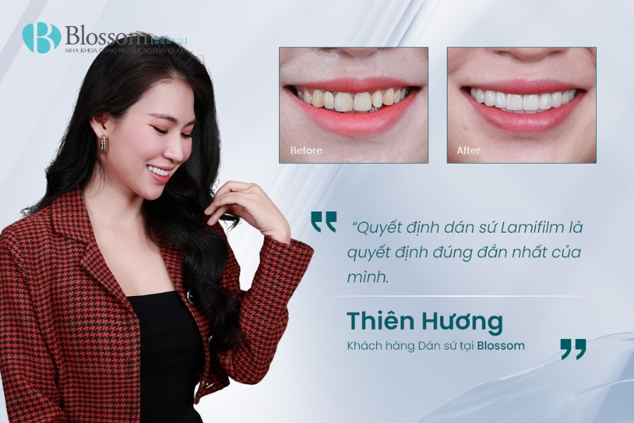 dan su khong mai o dau tot nhat 5