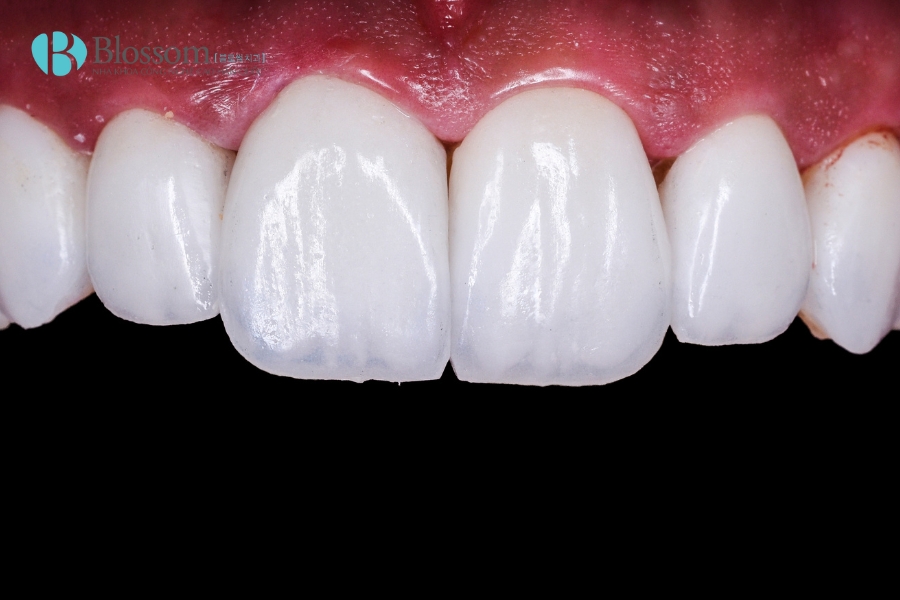 dan su khong mai o dau tot nhat 6