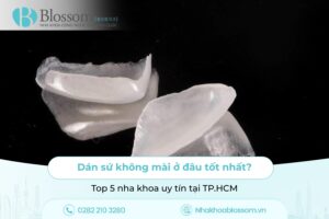 Dán sứ không mài ở đâu tốt nhất? Top 5 nha khoa uy tín tại TP.HCM