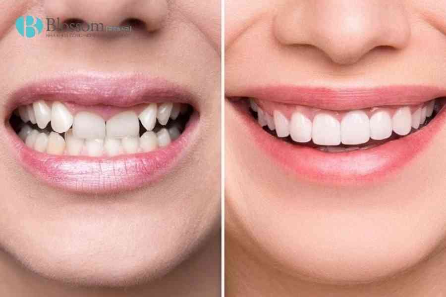 dan su thay doi khuon mat 3