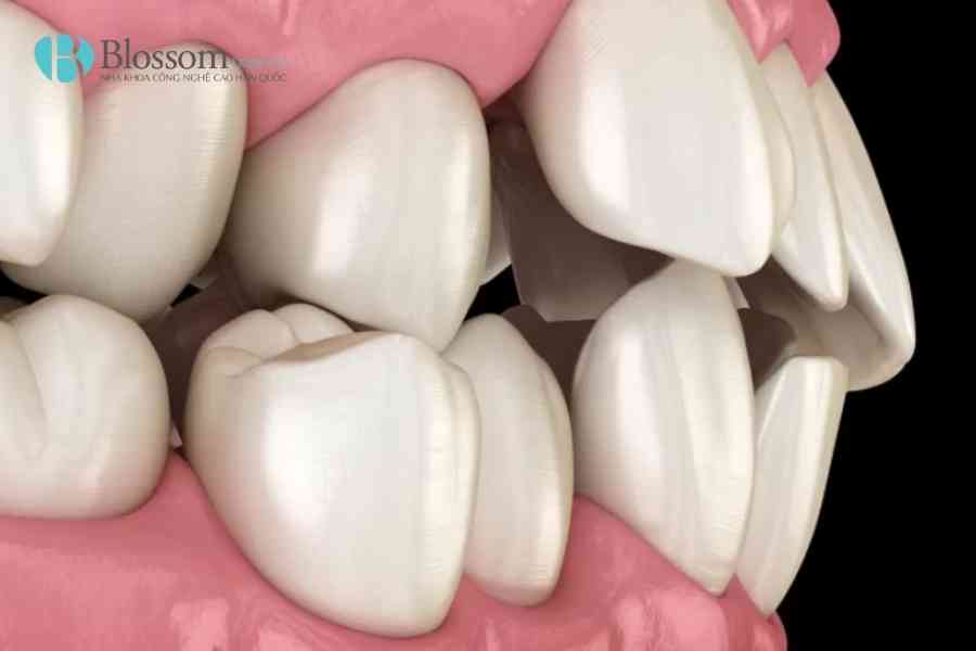 dan su thay doi khuon mat 4