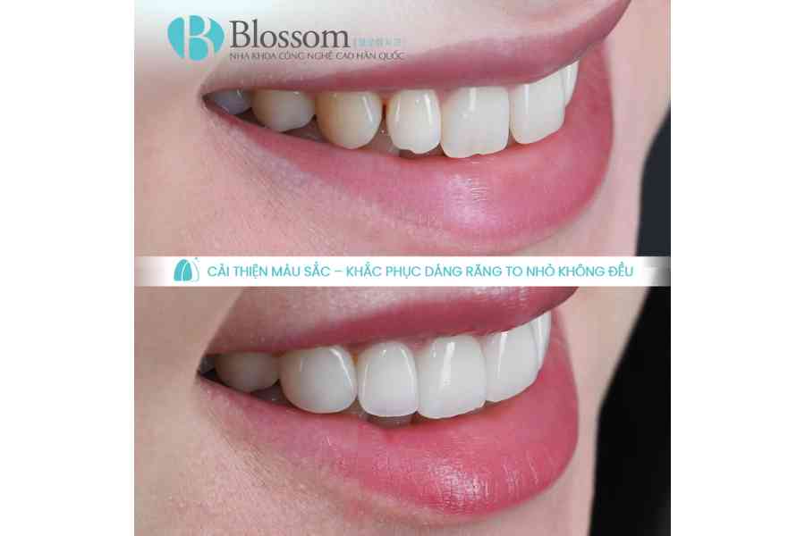 dan su thay doi khuon mat 5