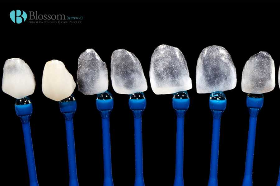 Ưu điểm của dán sứ không mài Lamifilm: Giải pháp thẩm mỹ bảo tồn răng tối ưu nhất hiện nay 2 uu diem cua dan su khong mai lamifilm 4