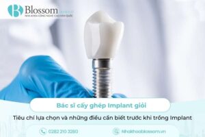 Bác sĩ cấy ghép Implant giỏi: Tiêu chí lựa chọn và những điều cần biết trước khi trồng Implant
