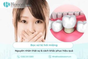Bọc sứ bị hôi miệng: Nguyên nhân thật sự & cách khắc phục hiệu quả