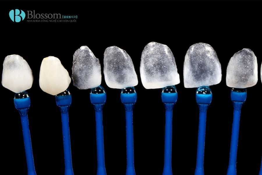 Răng sâu có dán sứ được không? Giải pháp phục hình phù hợp cho từng mức độ sâu răng 3 rang sau co dan su duoc khong 3