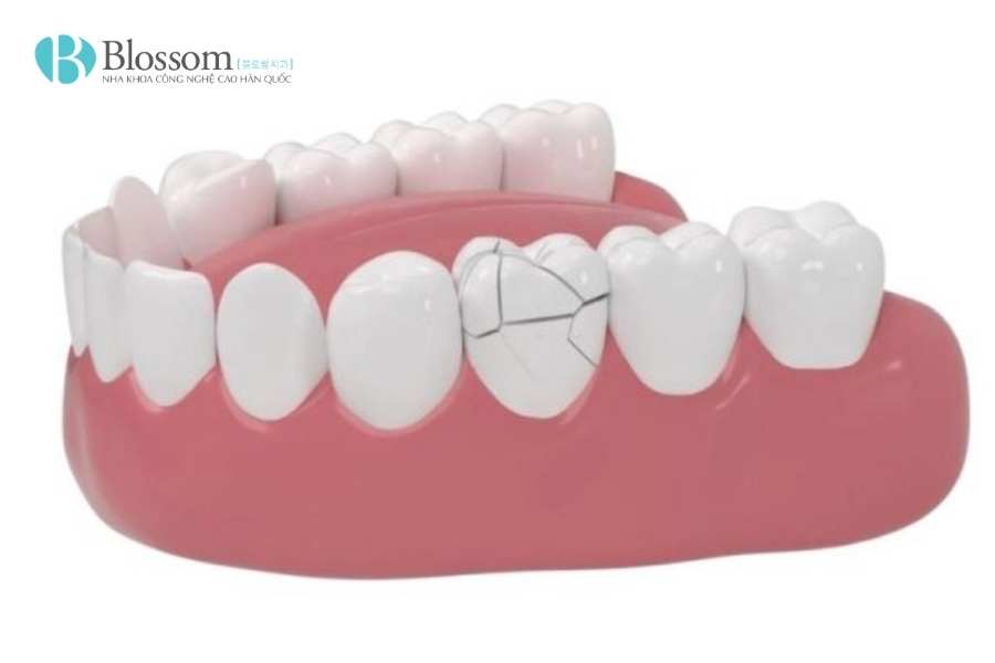 lam rang su khong mai o dau 3