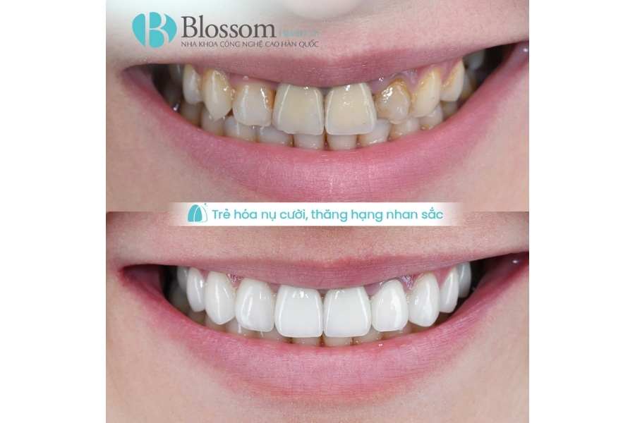 lam rang su khong mai o dau 4