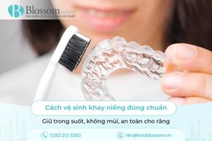 Cách vệ sinh khay niềng đúng chuẩn: Giữ trong suốt, không mùi, an toàn cho răng