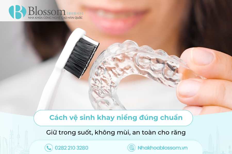 Cách vệ sinh khay niềng đúng chuẩn: Giữ trong suốt, không mùi, an toàn cho răng