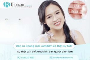 Dán sứ không mài Lamifilm có thật sự tốt? Sự thật cần biết trước khi bạn quyết định làm