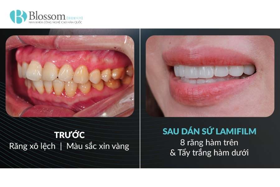 dan su nguyen ham 3