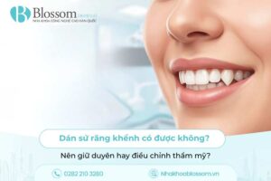 Dán sứ răng khểnh có được không? Nên giữ duyên hay điều chỉnh thẩm mỹ?
