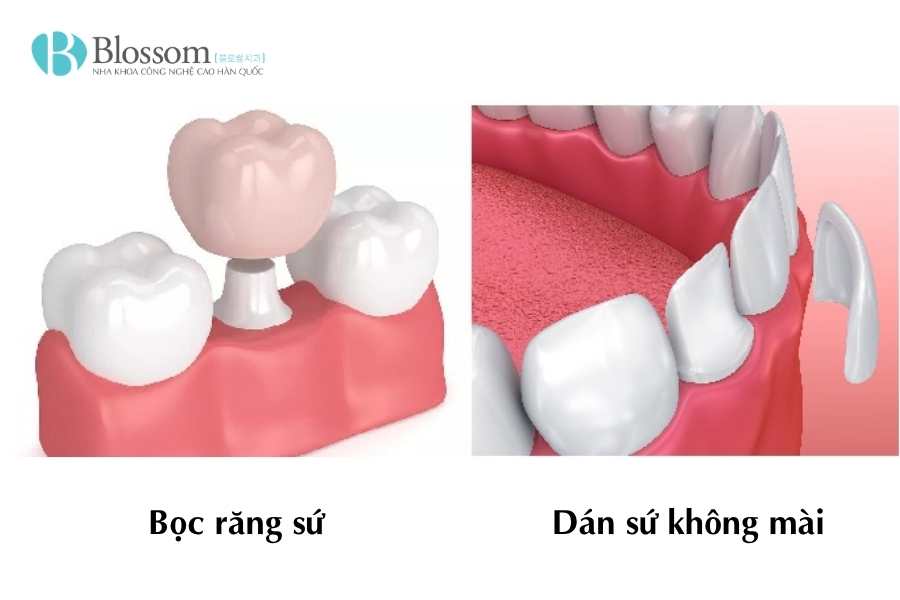 khong mai rang dan su duoc khong 4