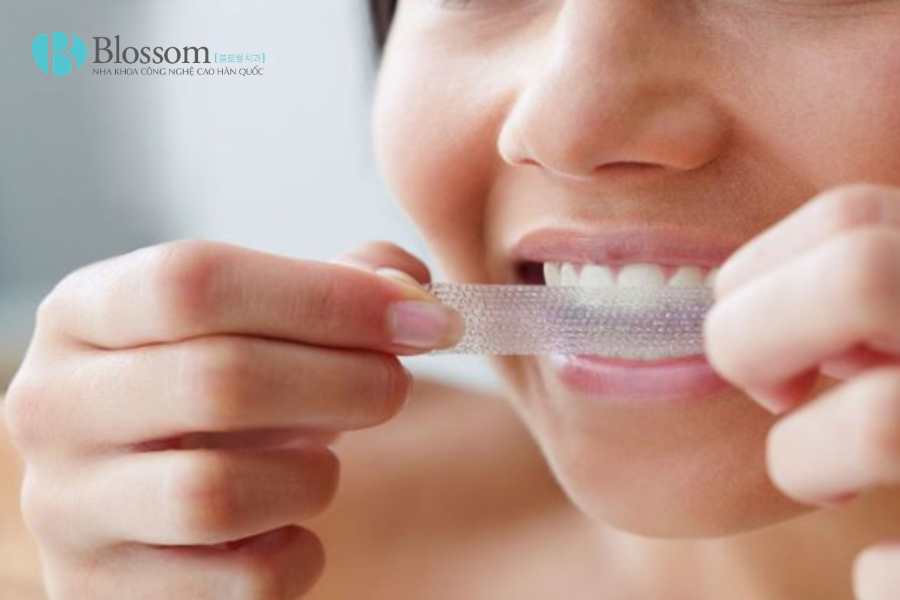 Miếng dán trắng răng có hiệu quả không? Cách dùng an toàn và những điều cần biết 1 mieng dan trang rang 1