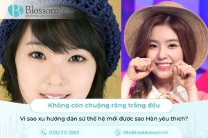 Không còn chuộng răng trắng đều: Vì sao xu hướng dán sứ thế hệ mới được sao Hàn yêu thích?