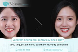 Lamifilm không mài có thực sự khác biệt? 5 yếu tố quyết định hiệu quả thẩm mỹ và độ bền lâu dài